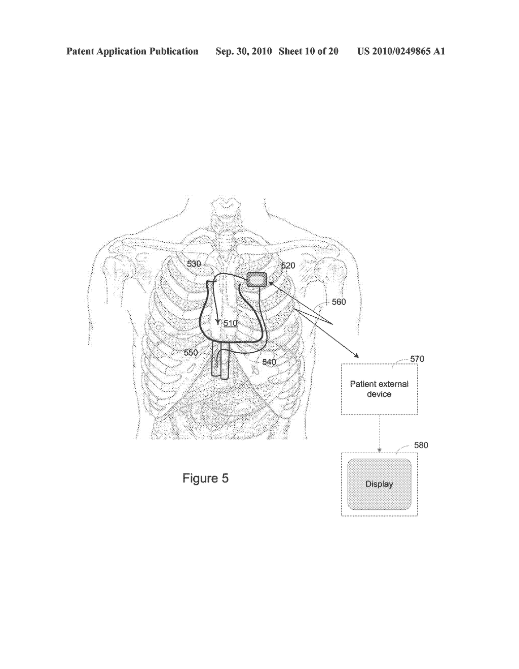 Systems and Methods for Anemia Detection, Monitoring, and Treatment - diagram, schematic, and image 11