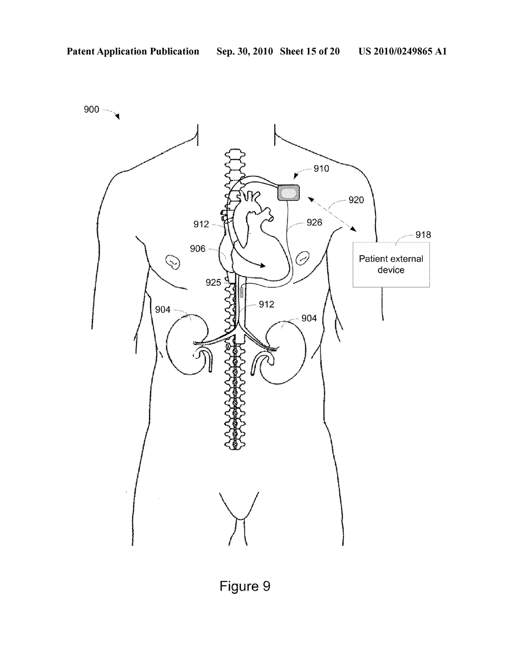 Systems and Methods for Anemia Detection, Monitoring, and Treatment - diagram, schematic, and image 16