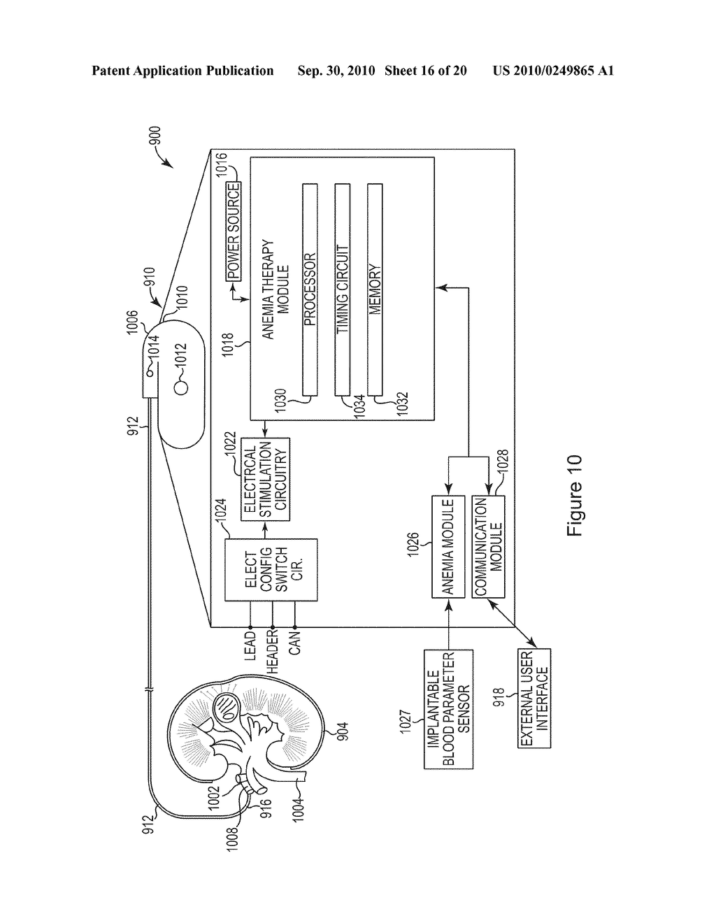 Systems and Methods for Anemia Detection, Monitoring, and Treatment - diagram, schematic, and image 17