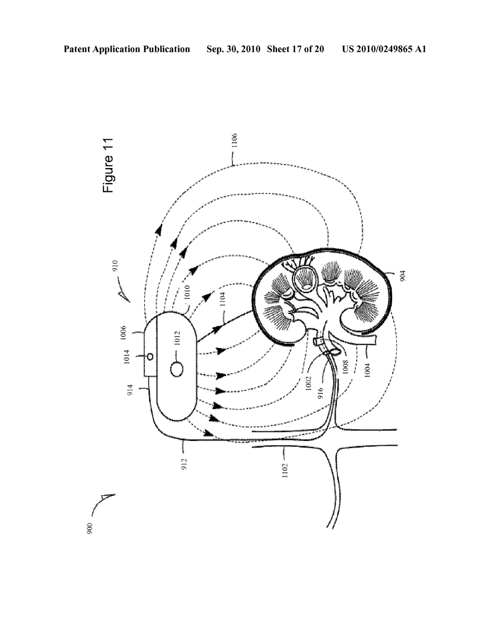 Systems and Methods for Anemia Detection, Monitoring, and Treatment - diagram, schematic, and image 18