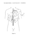 Systems and Methods for Anemia Detection, Monitoring, and Treatment diagram and image