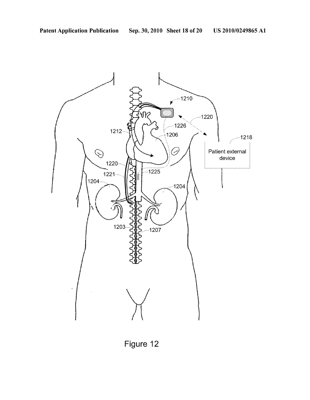 Systems and Methods for Anemia Detection, Monitoring, and Treatment - diagram, schematic, and image 19