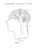 Systems and Methods for Anemia Detection, Monitoring, and Treatment diagram and image