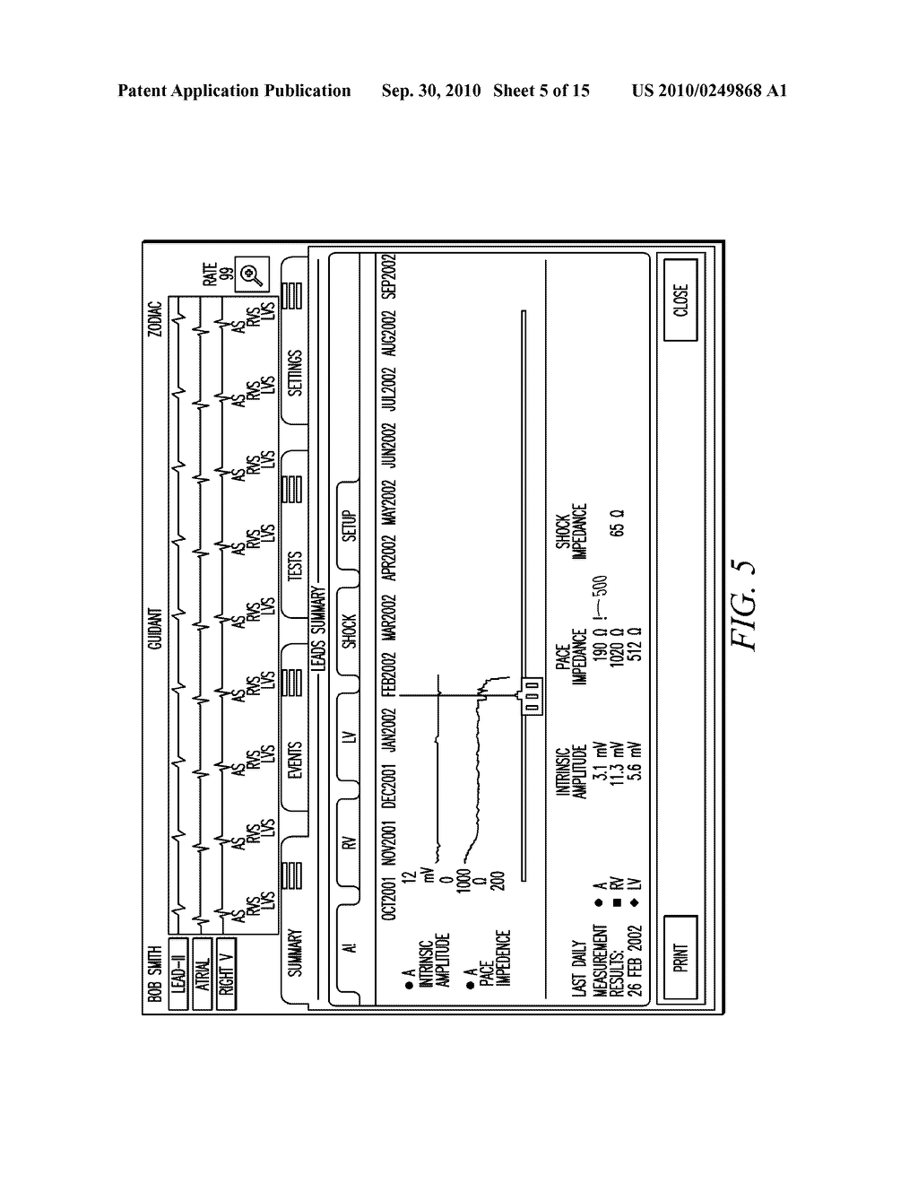 IMPLANTABLE MEDICAL DEVICE PROGRAMMING APPARATUS HAVING A GRAPHICAL USER INTERFACE - diagram, schematic, and image 06