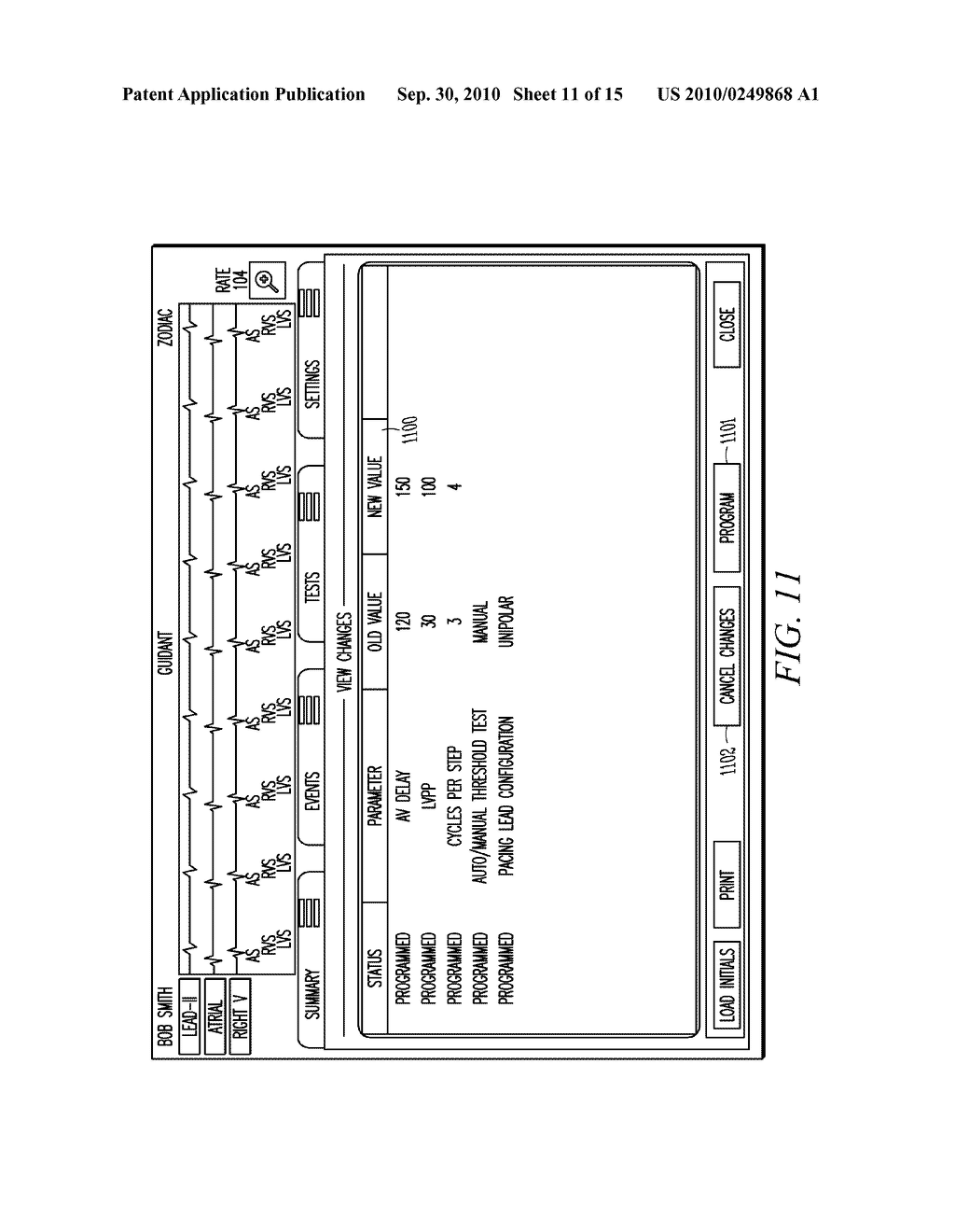 IMPLANTABLE MEDICAL DEVICE PROGRAMMING APPARATUS HAVING A GRAPHICAL USER INTERFACE - diagram, schematic, and image 12