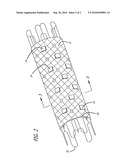 IMPLANTABLE APPARATUS FOR THE TREATMENT OF A SURFACE OF A DAMAGED VESSEL OR BODY CAVITY BY ELECTROMAGNETIC ENERGY diagram and image