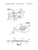 Medical Electrode Assembly diagram and image