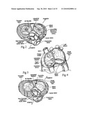PROSTHETIC HEART VALVE SYSTEM diagram and image