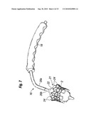 PROSTHETIC HEART VALVE SYSTEM diagram and image