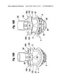 PROSTHETIC HEART VALVE SYSTEM diagram and image