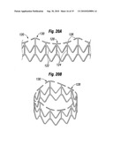 PROSTHETIC HEART VALVE SYSTEM diagram and image