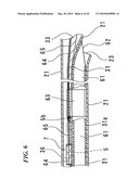 STENT DELIVERY SYSTEM diagram and image