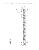 STENT DELIVERY SYSTEM diagram and image