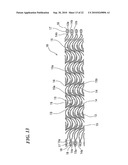 STENT DELIVERY SYSTEM diagram and image