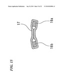 STENT DELIVERY SYSTEM diagram and image