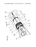 STENT DELIVERY SYSTEM diagram and image