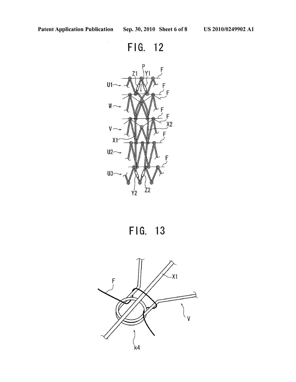 STENT AND TREATMENT DEVICE FOR TUBULAR ORGAN - diagram, schematic, and image 07