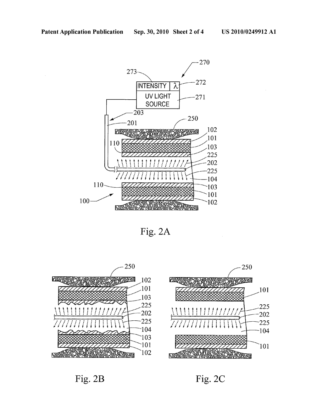 Intraluminal device with controlled biodegradation - diagram, schematic, and image 03