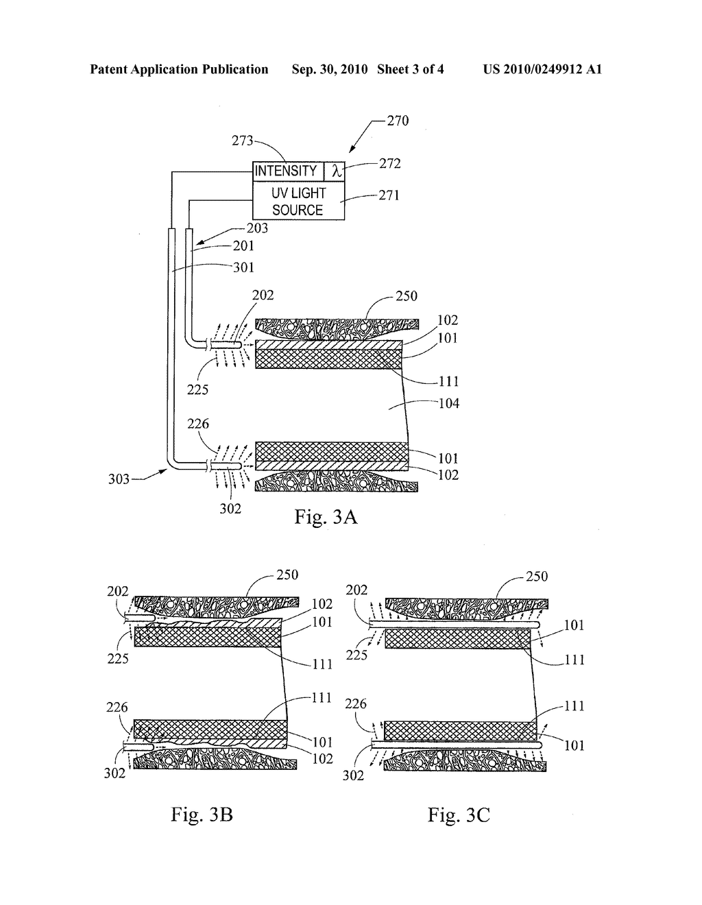 Intraluminal device with controlled biodegradation - diagram, schematic, and image 04