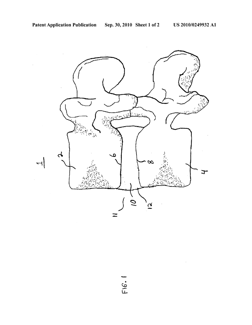 Materials, Devices and Methods for Intervertebral Stabilization Via Use of In Situ Shape Recovery - diagram, schematic, and image 02