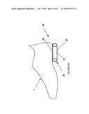 Shoe suspension system diagram and image