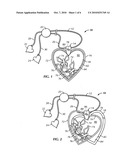 Adjustable Jewelry Assembly diagram and image