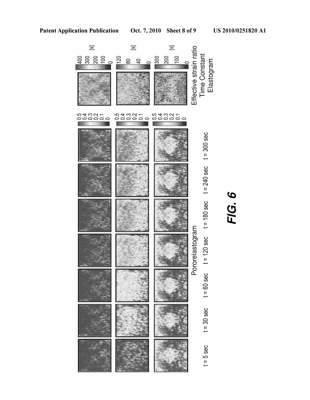 Method For Imaging Strain Of A Target Body - diagram, schematic, and image 09