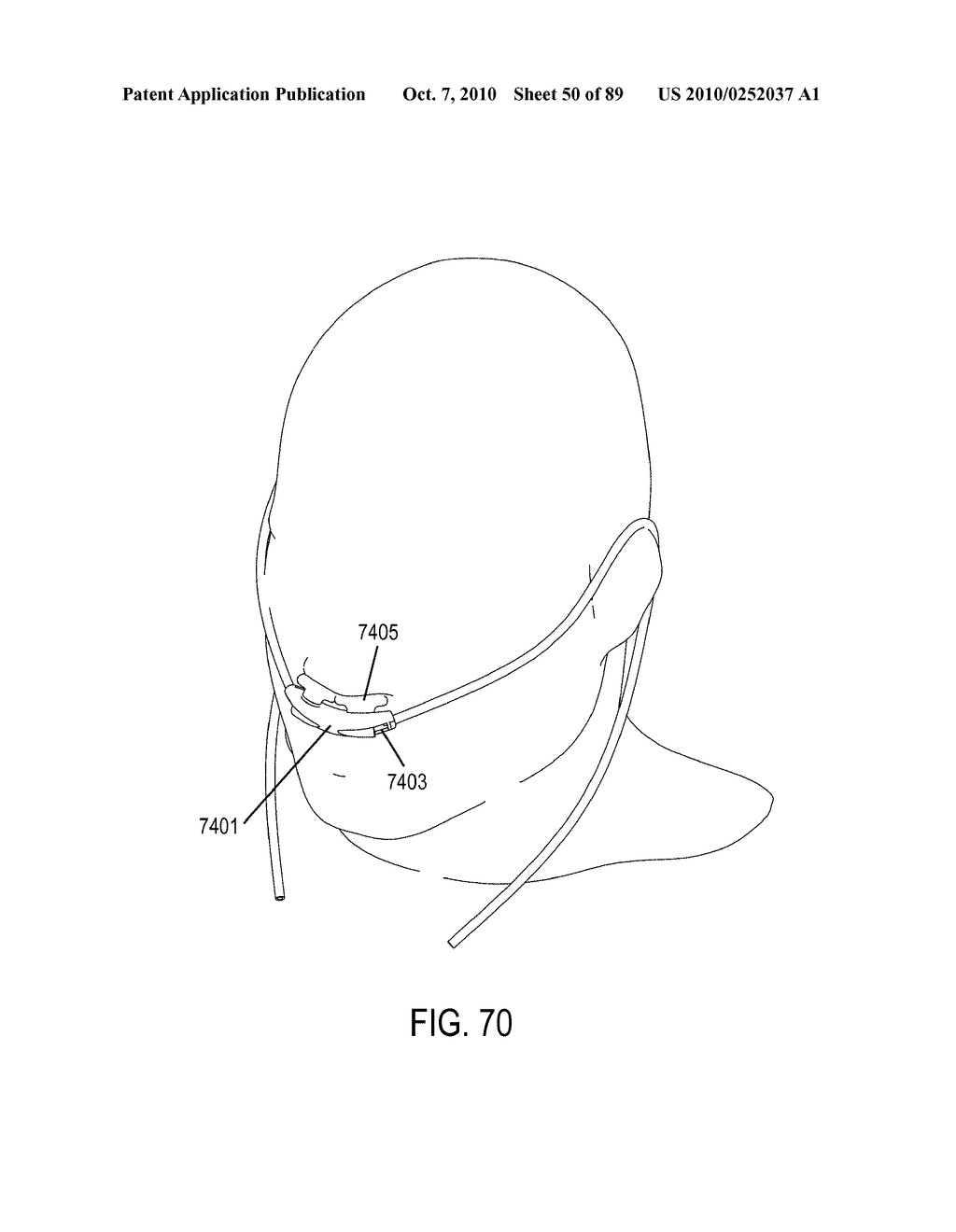 METHODS, SYSTEMS AND DEVICES FOR NON-INVASIVE OPEN VENTILATION WITH GAS DELIVERY NOZZLES WITHIN NASAL PILLOWS - diagram, schematic, and image 51