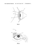 Ocular surface interferometery (OSI) devices and systems for imaging, processing, and/or displaying an ocular tear film diagram and image