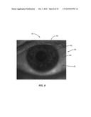 Ocular surface interferometery (OSI) devices and systems for imaging, processing, and/or displaying an ocular tear film diagram and image