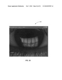 Ocular surface interferometery (OSI) devices and systems for imaging, processing, and/or displaying an ocular tear film diagram and image