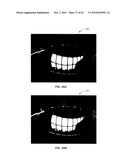 Ocular surface interferometery (OSI) devices and systems for imaging, processing, and/or displaying an ocular tear film diagram and image