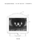 Ocular surface interferometery (OSI) devices and systems for imaging, processing, and/or displaying an ocular tear film diagram and image