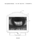 Ocular surface interferometery (OSI) devices and systems for imaging, processing, and/or displaying an ocular tear film diagram and image