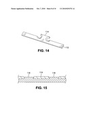 Load transmitting insert for a soft spline body diagram and image