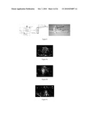 Seeds and Markers for Use in Imaging diagram and image