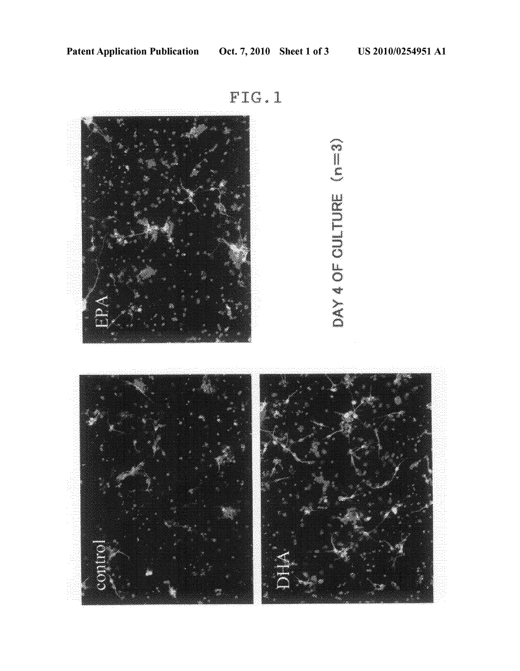 Nerve Regeneration Promoting Agent - diagram, schematic, and image 02