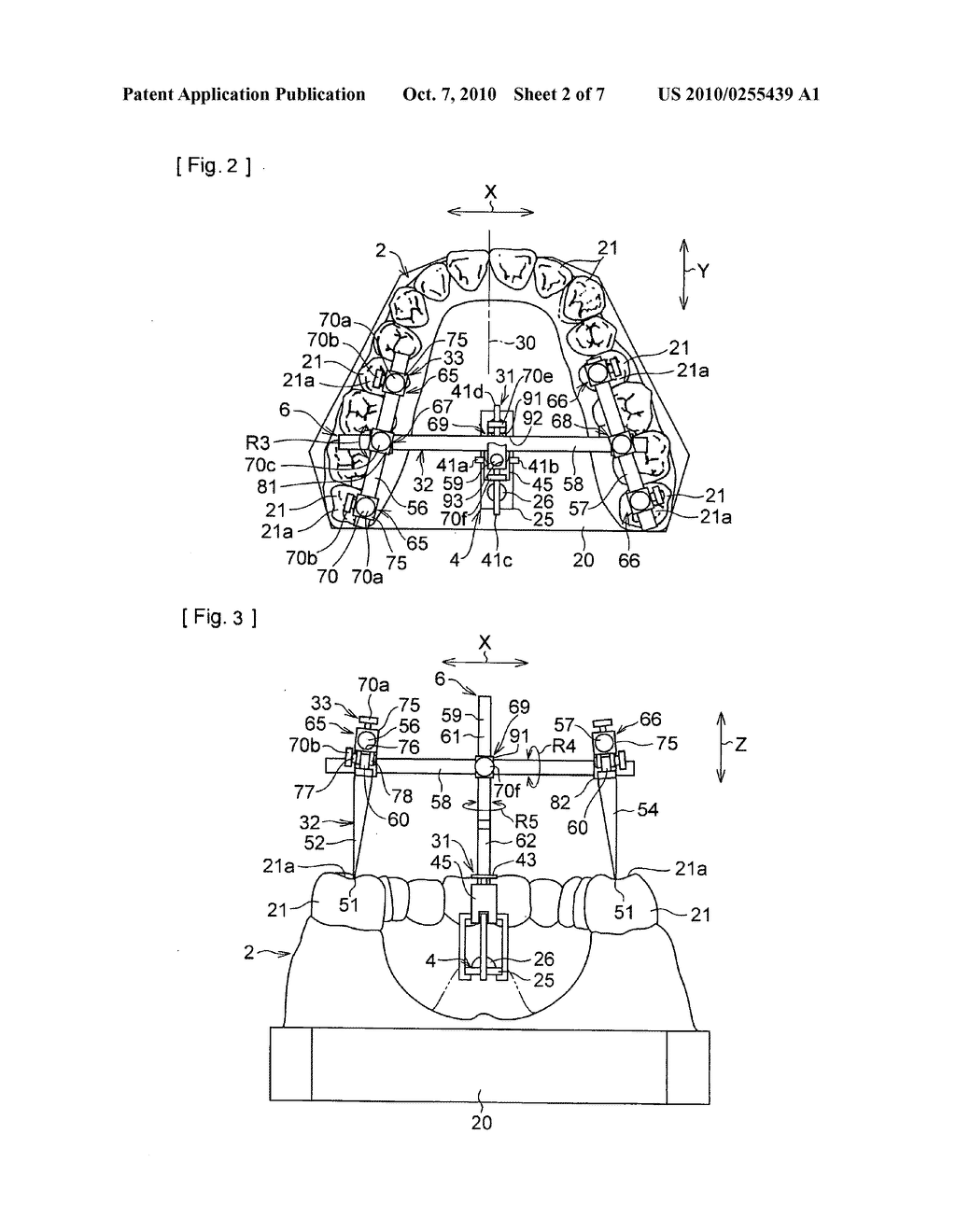 Orthodontics assisting system and index member and arranging device for use therein - diagram, schematic, and image 03