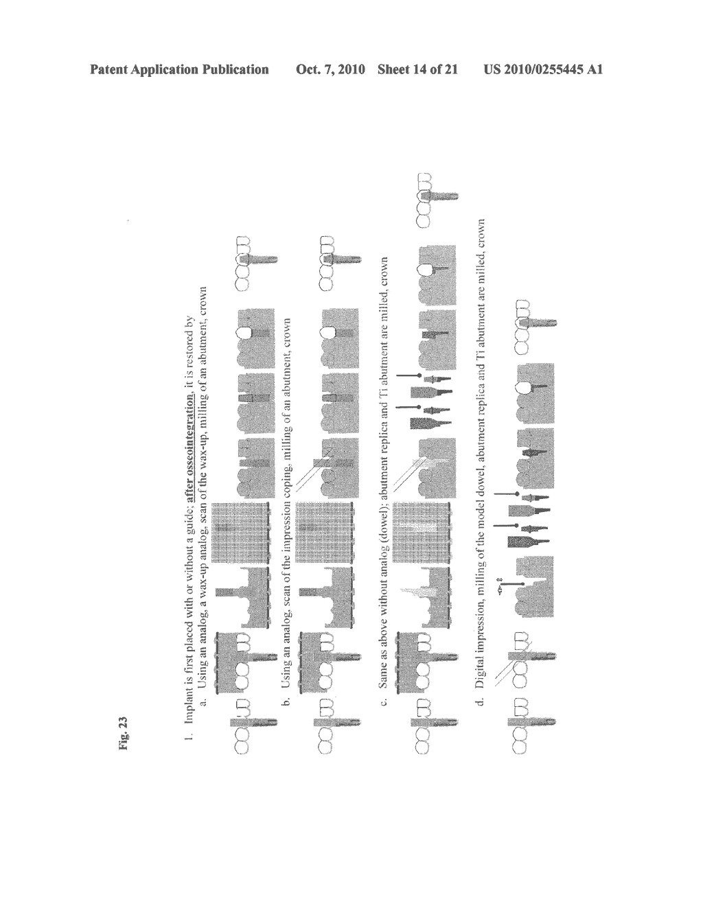 ASSISTED DENTAL IMPLANT TREATMENT - diagram, schematic, and image 15