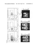 Single cell gene expression for diagnosis, prognosis and identification of drug targets diagram and image