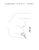 DEVICE FOR DETERMINING RISK OF DEVELOPING BREAST CANCER AND METHOD THEREOF diagram and image