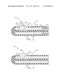 MEDICAL SYSTEM HAVING AN ULTRASOUND SOURCE AND AN ACOUSTIC COUPLING MEDIUM diagram and image