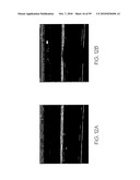 METHOD AND APPARATUS FOR MEDICAL IMAGING USING COMBINED NEAR-INFRARED OPTICAL TOMOGRAPHY, FLUORESCENT TOMOGRAPHY AND ULTRASOUND diagram and image