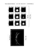 METHOD AND APPARATUS FOR MEDICAL IMAGING USING COMBINED NEAR-INFRARED OPTICAL TOMOGRAPHY, FLUORESCENT TOMOGRAPHY AND ULTRASOUND diagram and image