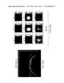 METHOD AND APPARATUS FOR MEDICAL IMAGING USING COMBINED NEAR-INFRARED OPTICAL TOMOGRAPHY, FLUORESCENT TOMOGRAPHY AND ULTRASOUND diagram and image