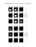 METHOD AND APPARATUS FOR MEDICAL IMAGING USING COMBINED NEAR-INFRARED OPTICAL TOMOGRAPHY, FLUORESCENT TOMOGRAPHY AND ULTRASOUND diagram and image