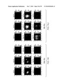 METHOD AND APPARATUS FOR MEDICAL IMAGING USING COMBINED NEAR-INFRARED OPTICAL TOMOGRAPHY, FLUORESCENT TOMOGRAPHY AND ULTRASOUND diagram and image