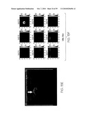 METHOD AND APPARATUS FOR MEDICAL IMAGING USING COMBINED NEAR-INFRARED OPTICAL TOMOGRAPHY, FLUORESCENT TOMOGRAPHY AND ULTRASOUND diagram and image