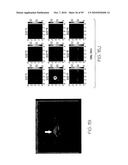 METHOD AND APPARATUS FOR MEDICAL IMAGING USING COMBINED NEAR-INFRARED OPTICAL TOMOGRAPHY, FLUORESCENT TOMOGRAPHY AND ULTRASOUND diagram and image