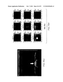 METHOD AND APPARATUS FOR MEDICAL IMAGING USING COMBINED NEAR-INFRARED OPTICAL TOMOGRAPHY, FLUORESCENT TOMOGRAPHY AND ULTRASOUND diagram and image